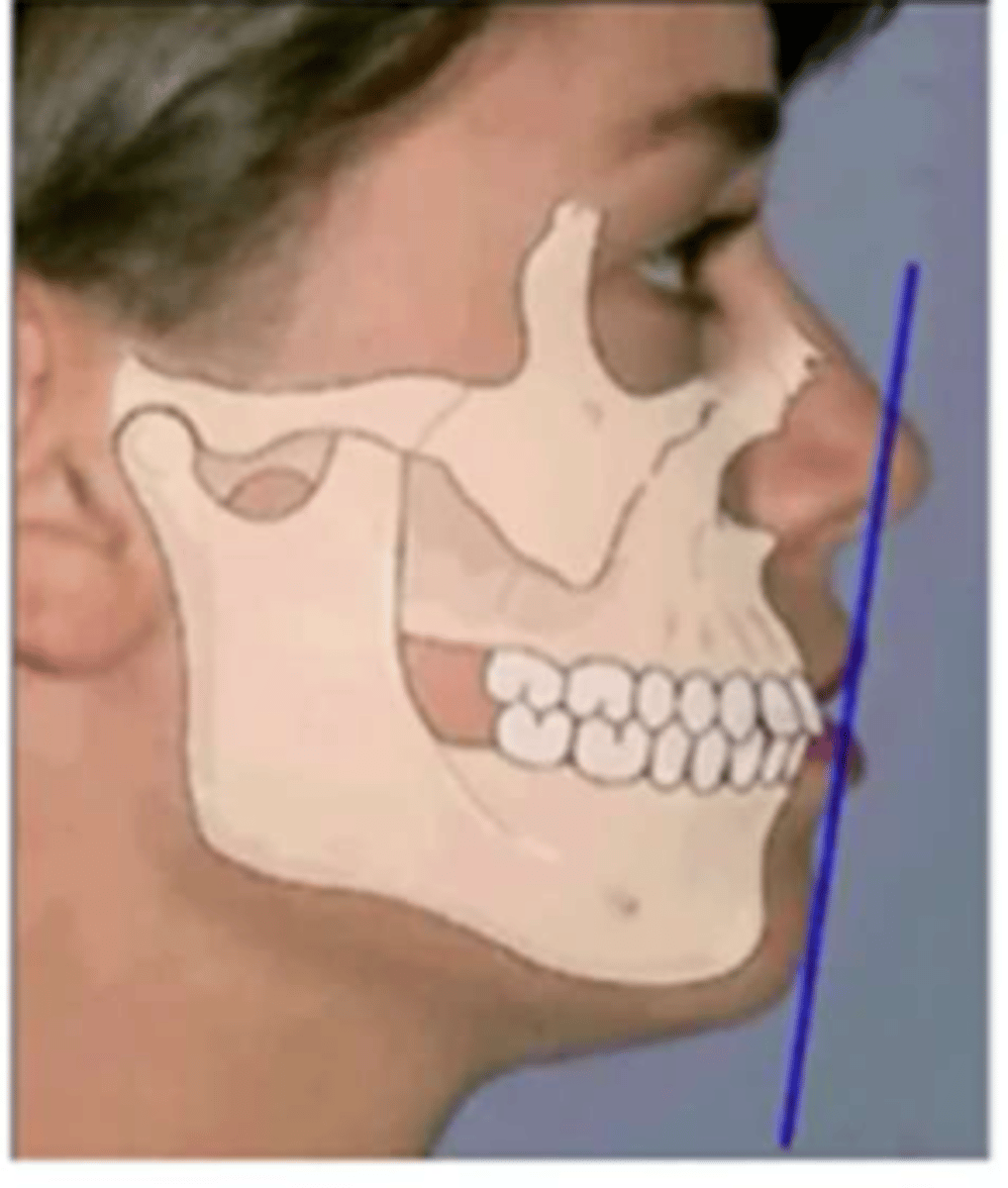 <p>What is the lip posture described as?</p>