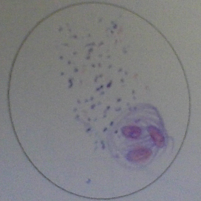 <p>Dinoflagellates</p>