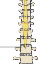 <p>What structure is this and what vertebrae does it occur at</p>
