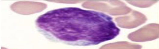 <p>What species does this lymphocyte belong to?</p>