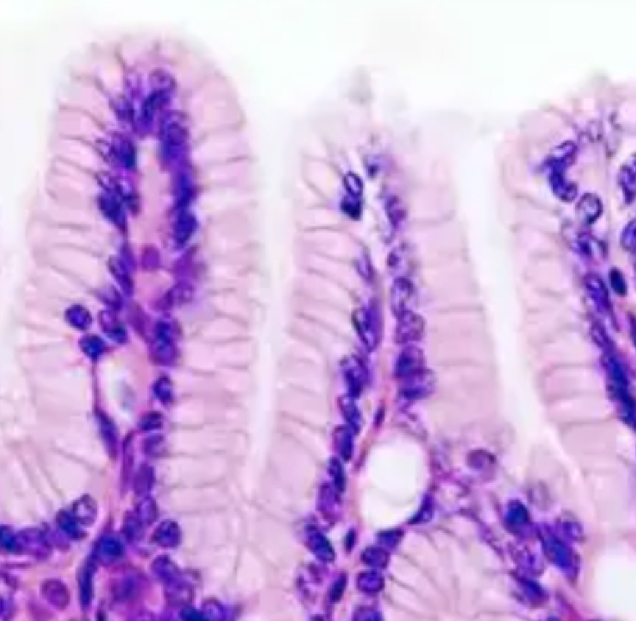 <p>What is the structural foundation of <strong>simple columnar epithelium</strong></p>