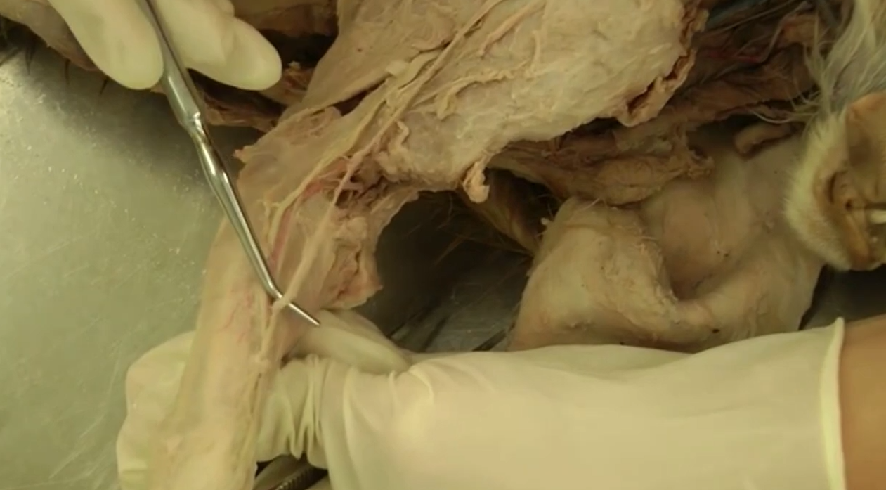 <p>vein</p>