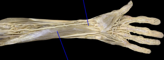 <p>what is the 2nd tagged (from left to right) area? Then state the origin, insertion, and main actions.</p>