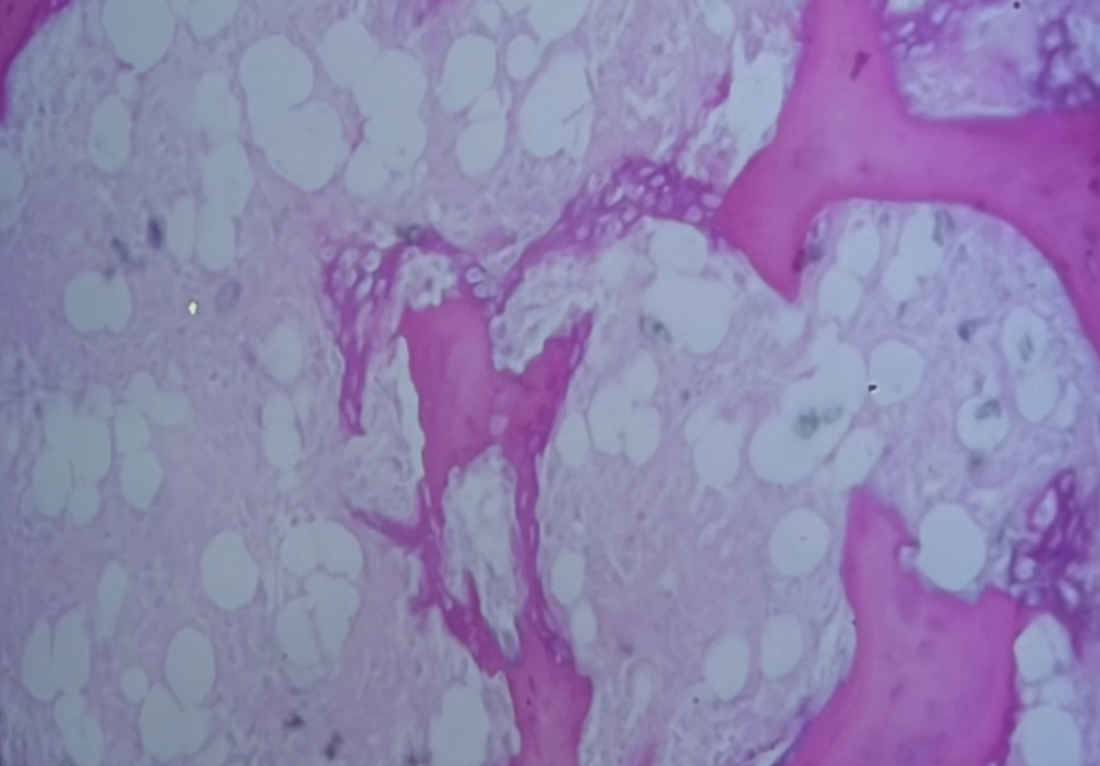 <ol><li><p>Sickle Cell Anemia</p></li><li><p>Atherosclerosis</p></li><li><p>Adenocarcinoma of Kidney</p></li><li><p>Osteogenic Sarcoma of Bone</p></li><li><p>Tattoo in Human Skin</p></li><li><p>Neurilemmoma</p></li><li><p>Anthracosis of the Lung</p></li><li><p>Basal Cell Carcinoma</p></li><li><p>Lung</p></li><li><p>Skeletal</p></li><li><p>Kidney</p></li><li><p>Neuron</p></li><li><p>Skin</p></li><li><p>Blood</p></li><li><p>Bone</p></li><li><p>Aorta</p></li></ol><p></p>