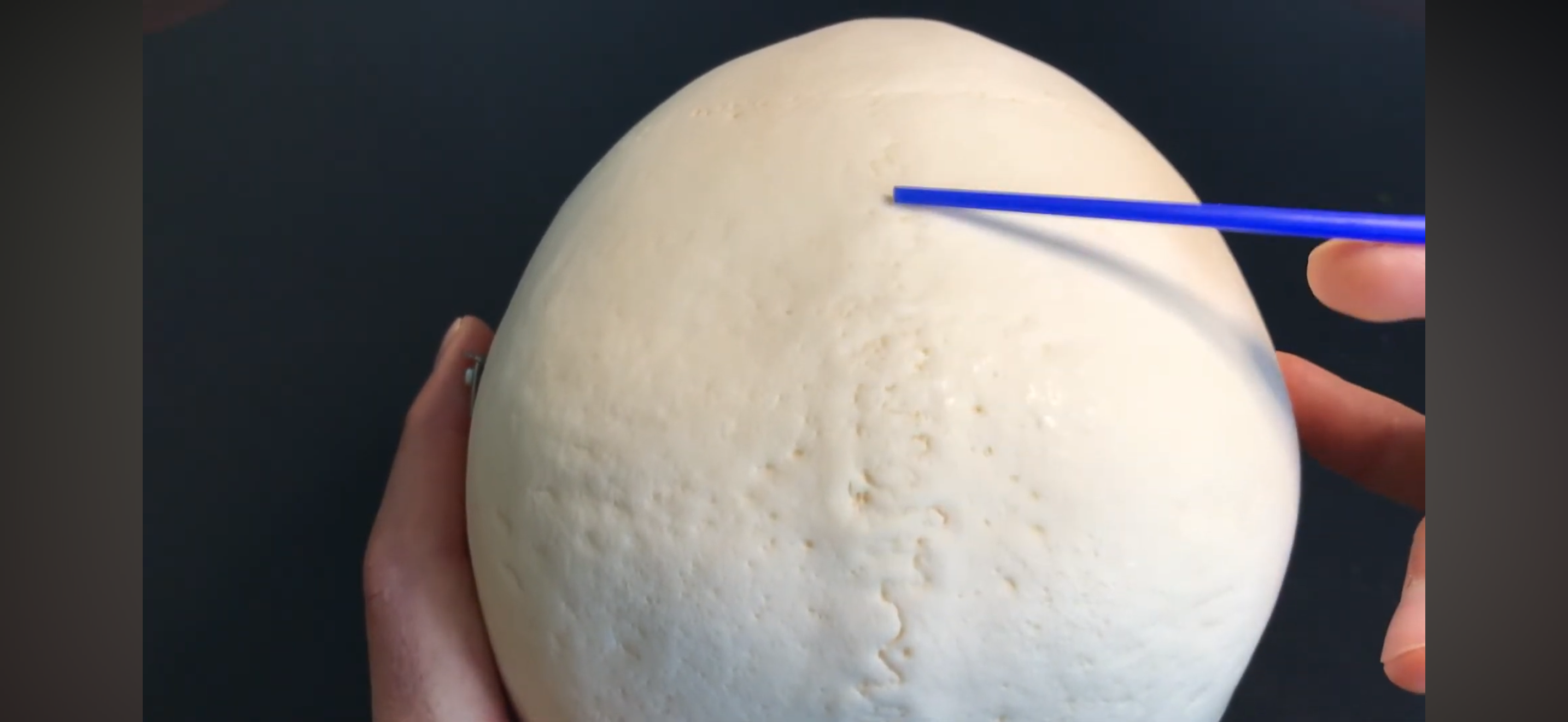 <p>What is the suture?</p>