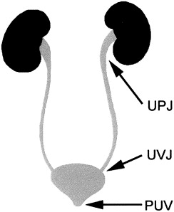 <p>then those structures that are positioned proximal to the obstruction will be dilated ( entire ureter, the renal pelvis, and the renal calices will be eventually dilated and filled with urine.)</p>