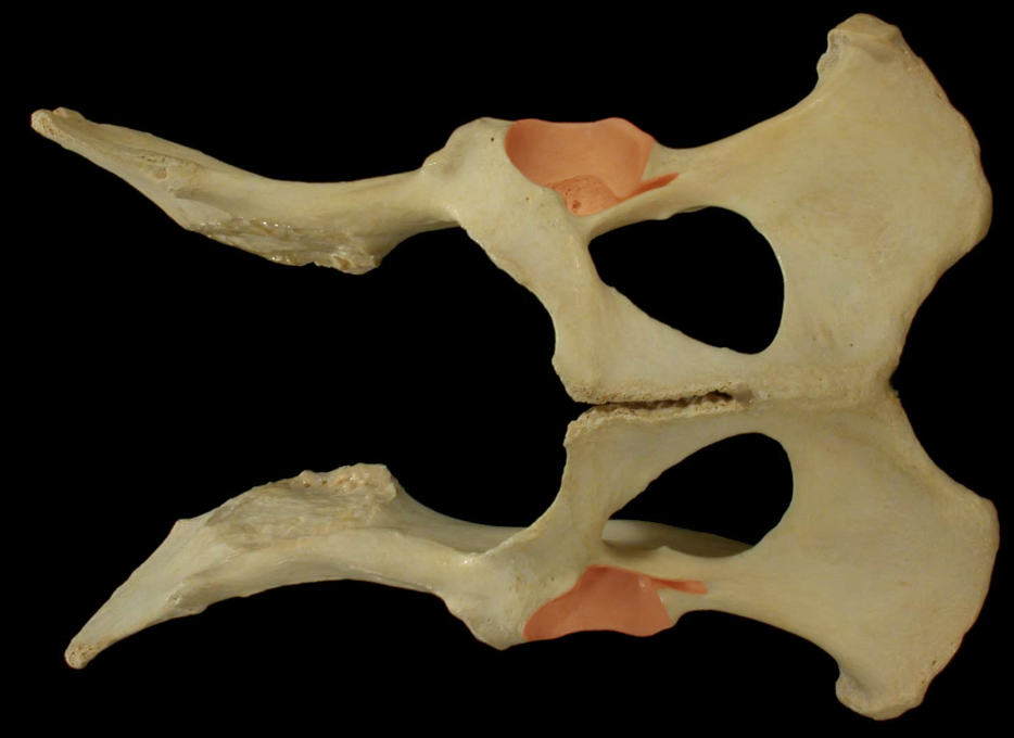 <p>Acetabulum</p>