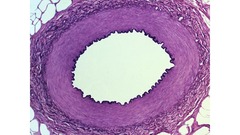 <p>Artery</p>