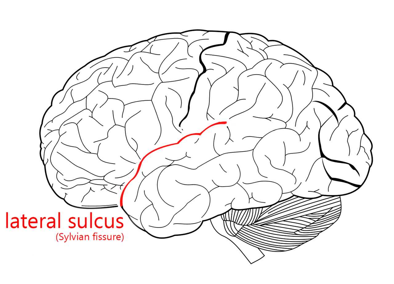 <p>Lateral Fissure</p>