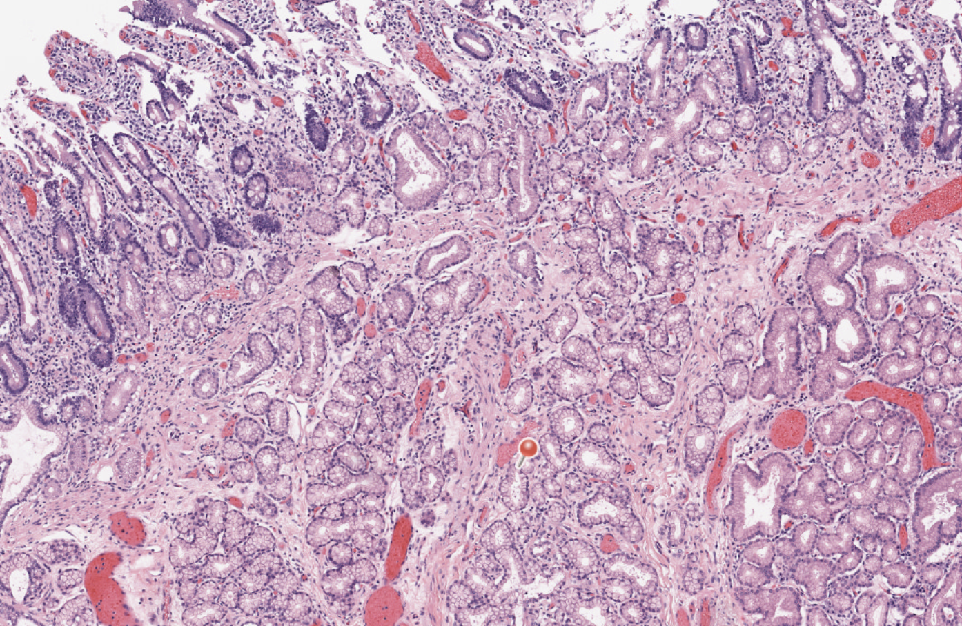 <p>Duodenum</p><p>The duodenum—the first section of the small intestine—features the four standard gastrointestinal layers: mucosa, submucosa, muscularis externa, and adventitia. Its defining histological characteristic is the presence of Brunner's glands in the submucosa, which secrete alkaline mucus to neutralize acidic stomach chyme.</p>