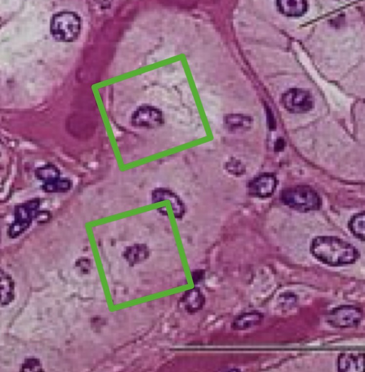<p>This tissue is found modified in the acini of the pancreas.</p>
