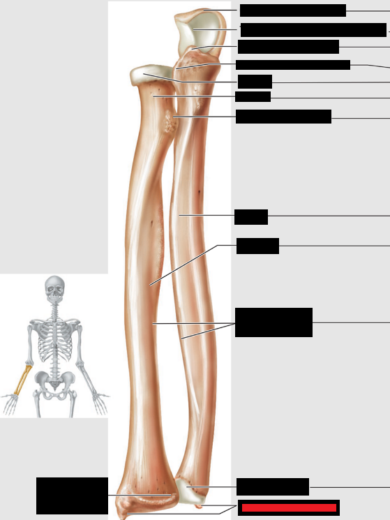 <p>Which part of the forearm is this?</p>