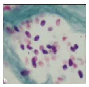 <p>-Fungi</p><p>-Spores <4 um</p>