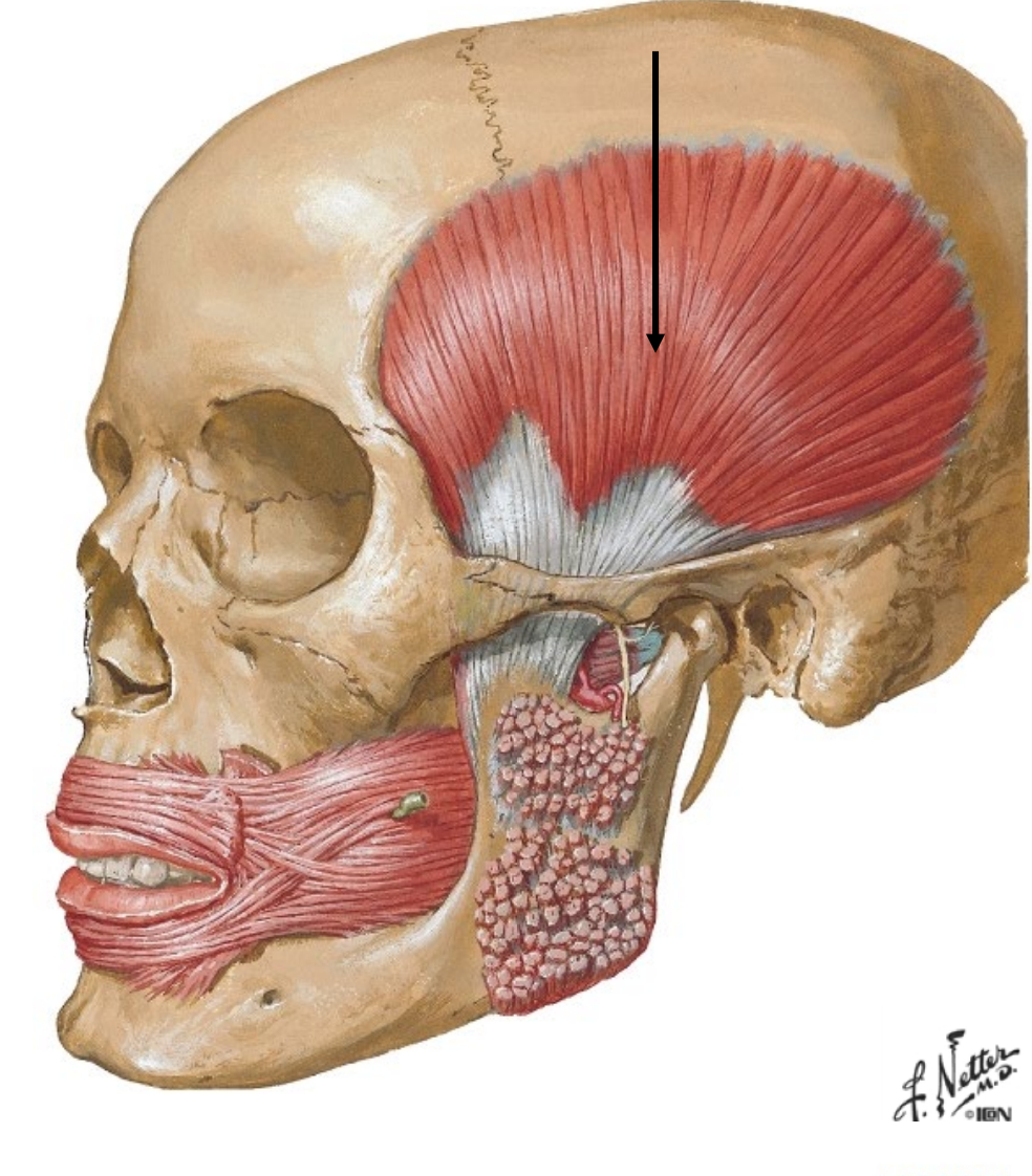 <p>Origin: <span style="color: rgb(1, 255, 70);"><strong>Temporal fossa</strong></span></p>