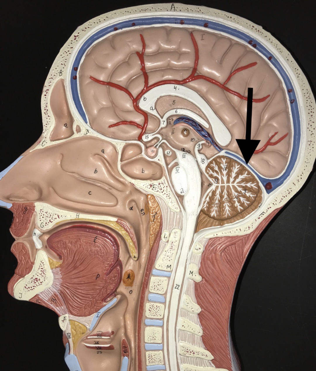 <p>What is the arrow pointing to?</p>