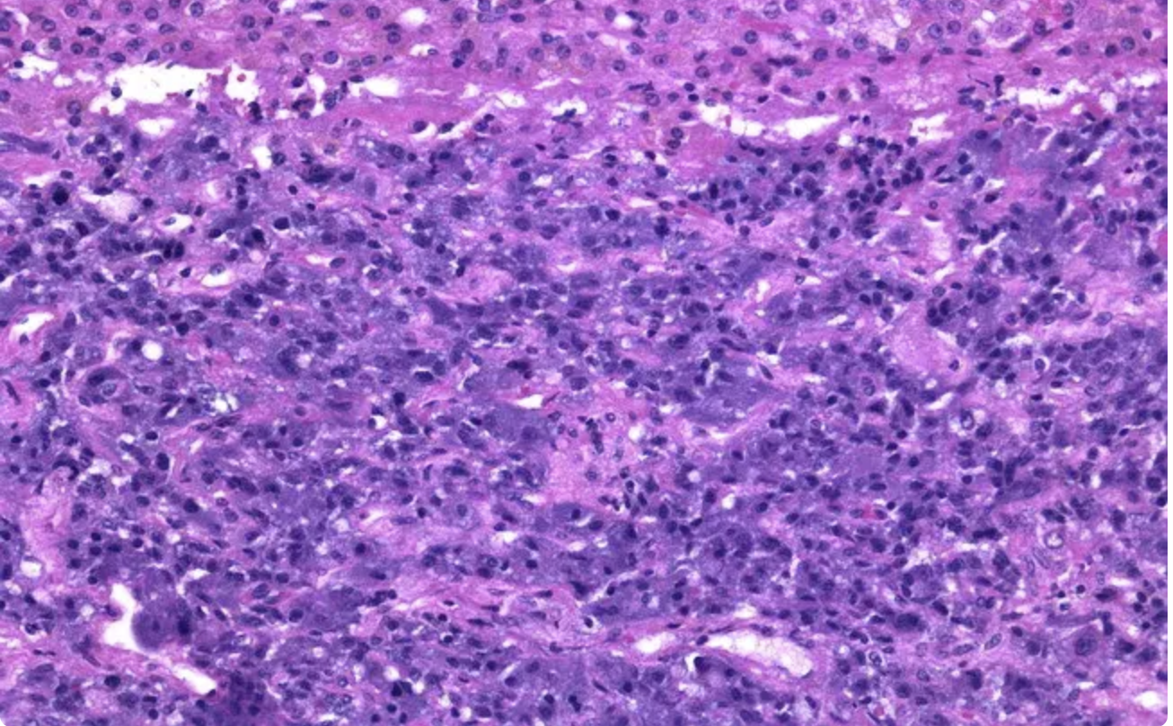 <p>Décrire les cellules de la médulla et leur fonction </p>