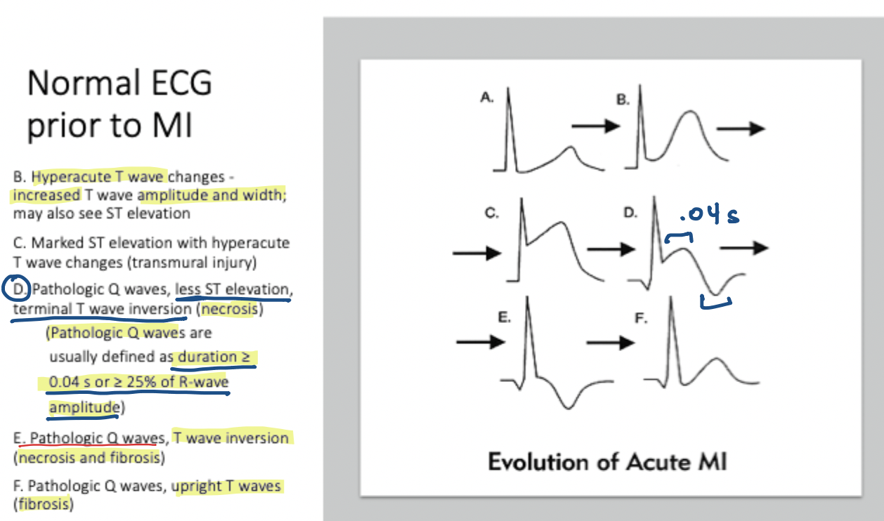 <p>True or False: Fibrous tissue can contribute to the heart's pumping action.</p>