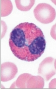 <p>Eosinophil</p>
