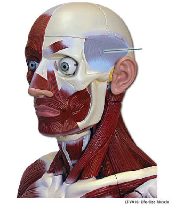 term image