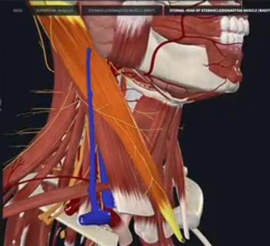 term image