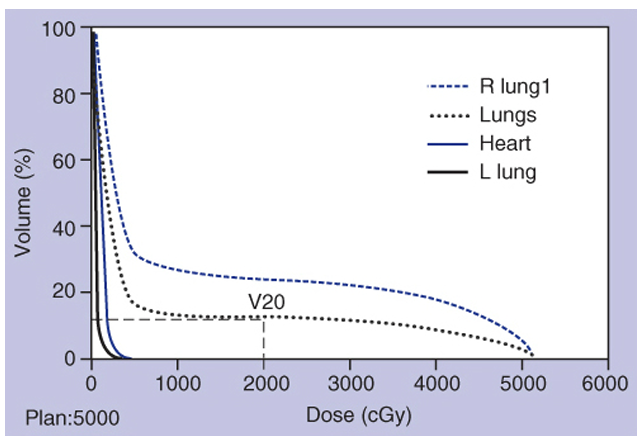 <p>Dose Volume Histogram (DVH) </p>