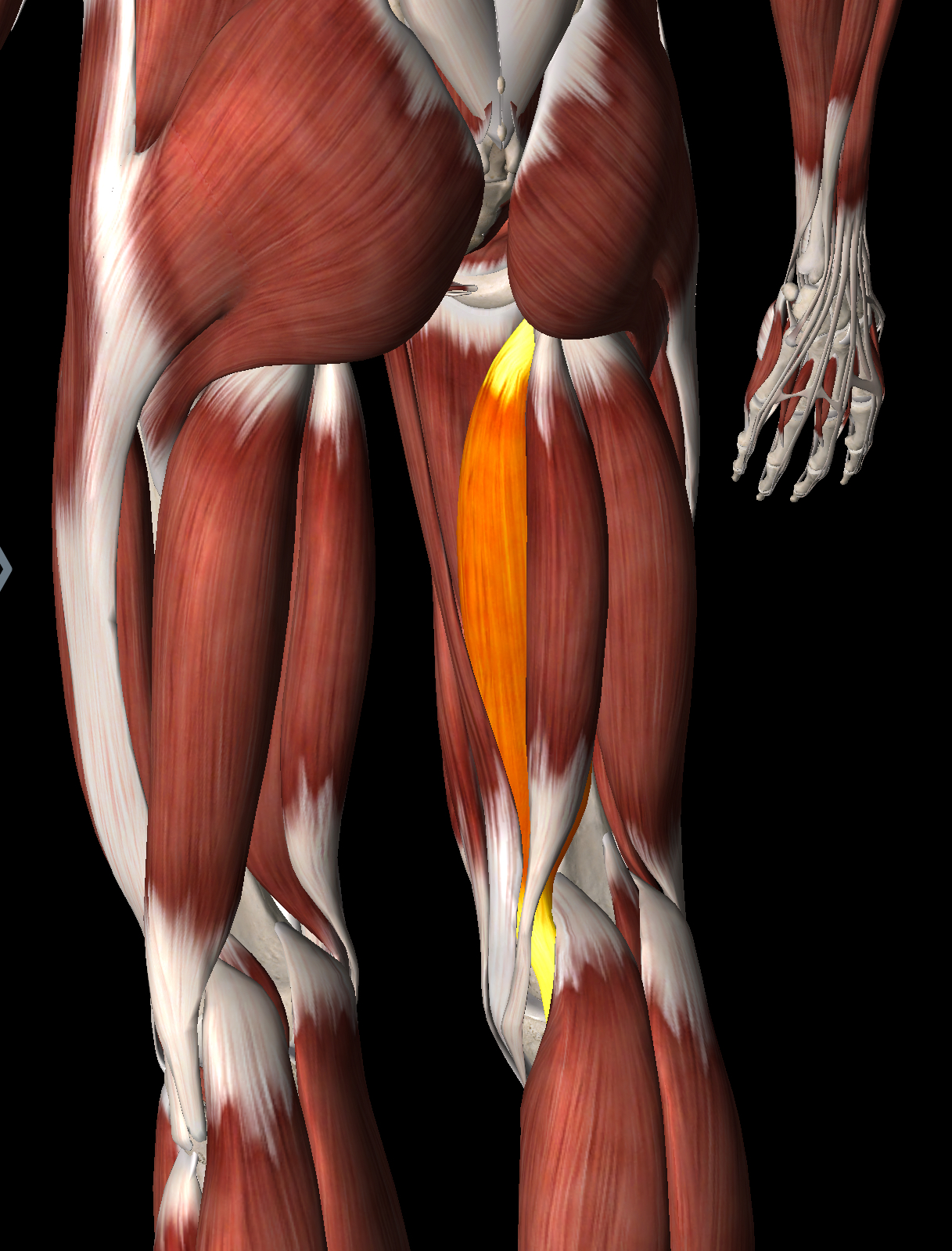 <p>What muscle is this?</p>