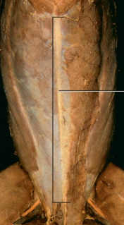 <p>• The left and right abdominal muscles meet on ventral midline forming an aponeurosis called the linea alba (white line)</p>