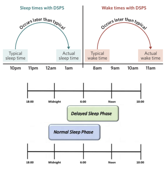 <p><span style="background-color: inherit; line-height: 20.7px; color: windowtext;"><strong>Delayed sleep phase syndrome (DSPS)</strong> is a type of circadian rhythm sleep disorder characterised by a later sleep onset time and a later awakening time compared with the time that is desired</span><span style="line-height: 20.7px; color: windowtext;">/accepted/conventional</span></p><ul><li><p class="Paragraph SCXO127159873 BCX0" style="text-align: left;"><span style="background-color: inherit; line-height: 20.7px; color: windowtext;">In this way, the sleep-wake cycle is delayed – where melatonin is released later</span><span style="line-height: 20.7px; color: windowtext;"> </span></p></li><li><p class="Paragraph SCXO127159873 BCX0" style="text-align: left;"><span style="background-color: inherit; line-height: 20.7px; color: windowtext;">Sleep is usually 2 or more hours later than needed/acceptable</span><span style="line-height: 20.7px; color: windowtext;"> </span></p></li><li><p class="Paragraph SCXO127159873 BCX0" style="text-align: left;"><span style="background-color: inherit; line-height: 20.7px; color: windowtext;">To be diagnosed with DSPS, a person needs to experience symptoms for more than 3 months</span><span style="line-height: 20.7px; color: windowtext;"> </span></p></li><li><p class="Paragraph SCXO127159873 BCX0" style="text-align: left;"><span style="background-color: inherit; line-height: 20.7px; color: windowtext;">e.g. if an individual typically starts sleeping at 10pm and wakes at 8am, with DSPS they may instead start sleeping at 1am and wake at 11am</span><span style="line-height: 20.7px; color: windowtext;"> </span></p></li></ul><p></p>