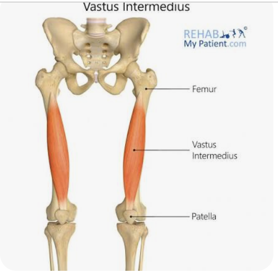 <p>O: Body of femur</p><p>I: Patella, tibial tuberosity</p><p>A: Extension of the leg</p><p>N: Femoral nerve</p>