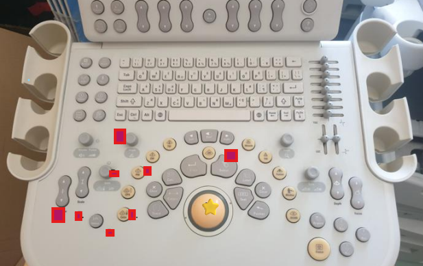 <p><strong>Trackball/ scroll ball</strong> – moves the cursor and is used for measurements and tracing structures on the image.</p>