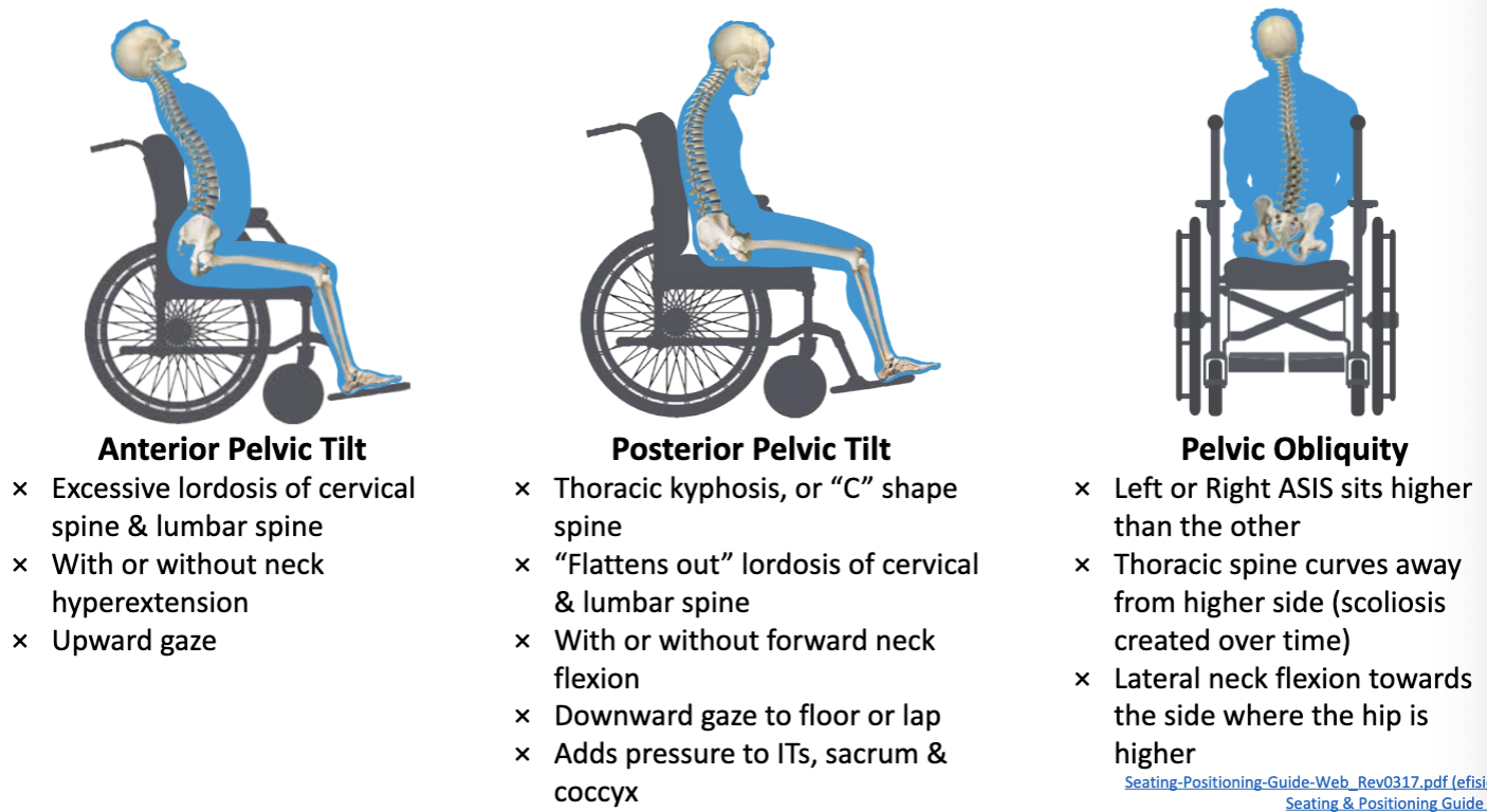 <p>Sitting-Poor Positioning</p>