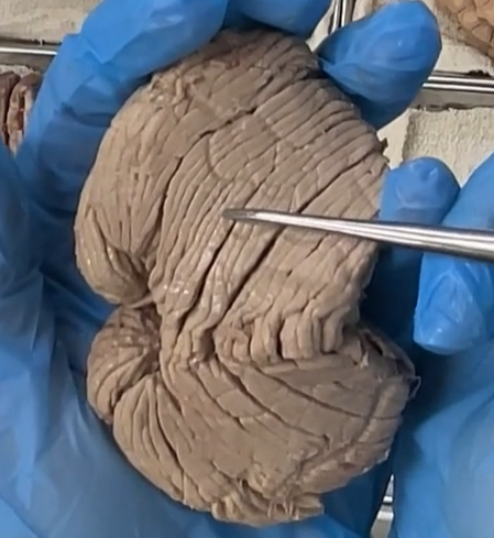 <p>There are little folds called “folia”, which are separated by sulci. </p>