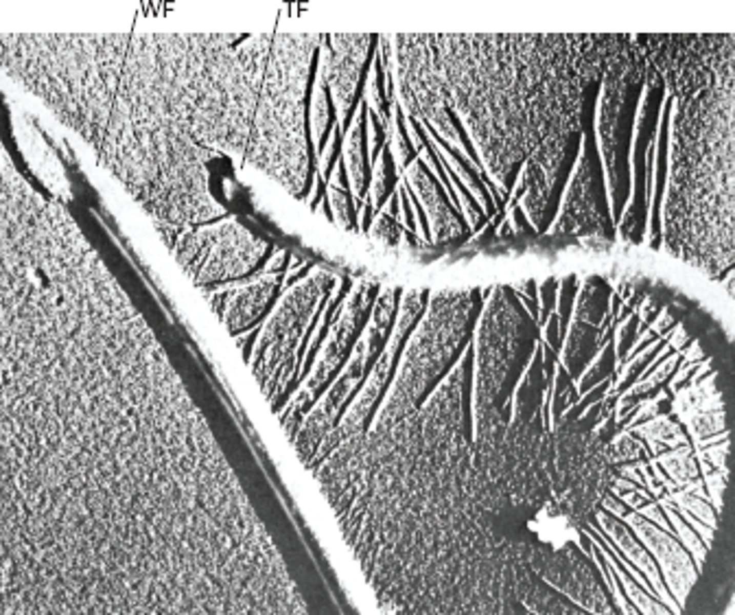 <p>long "hairy" flagellum & shorter "smooth" flagellum</p>