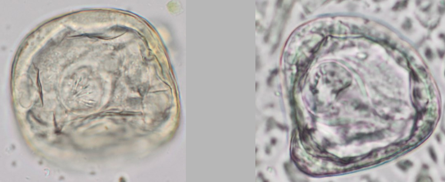 <p>Tapeworms in Domestic Livestock</p>