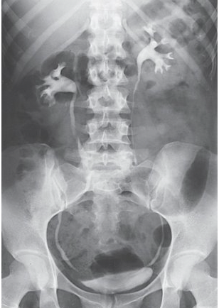 <p> What is this projection?</p>