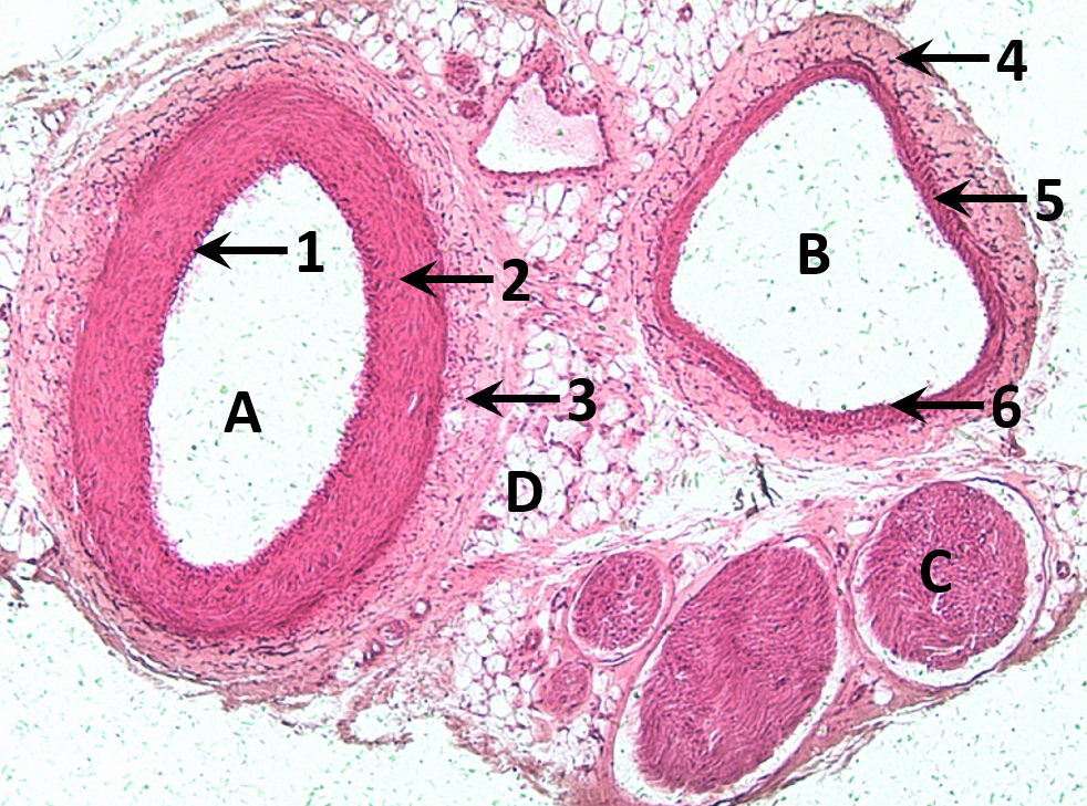 <p>Identify the structure indicated by 3.</p>