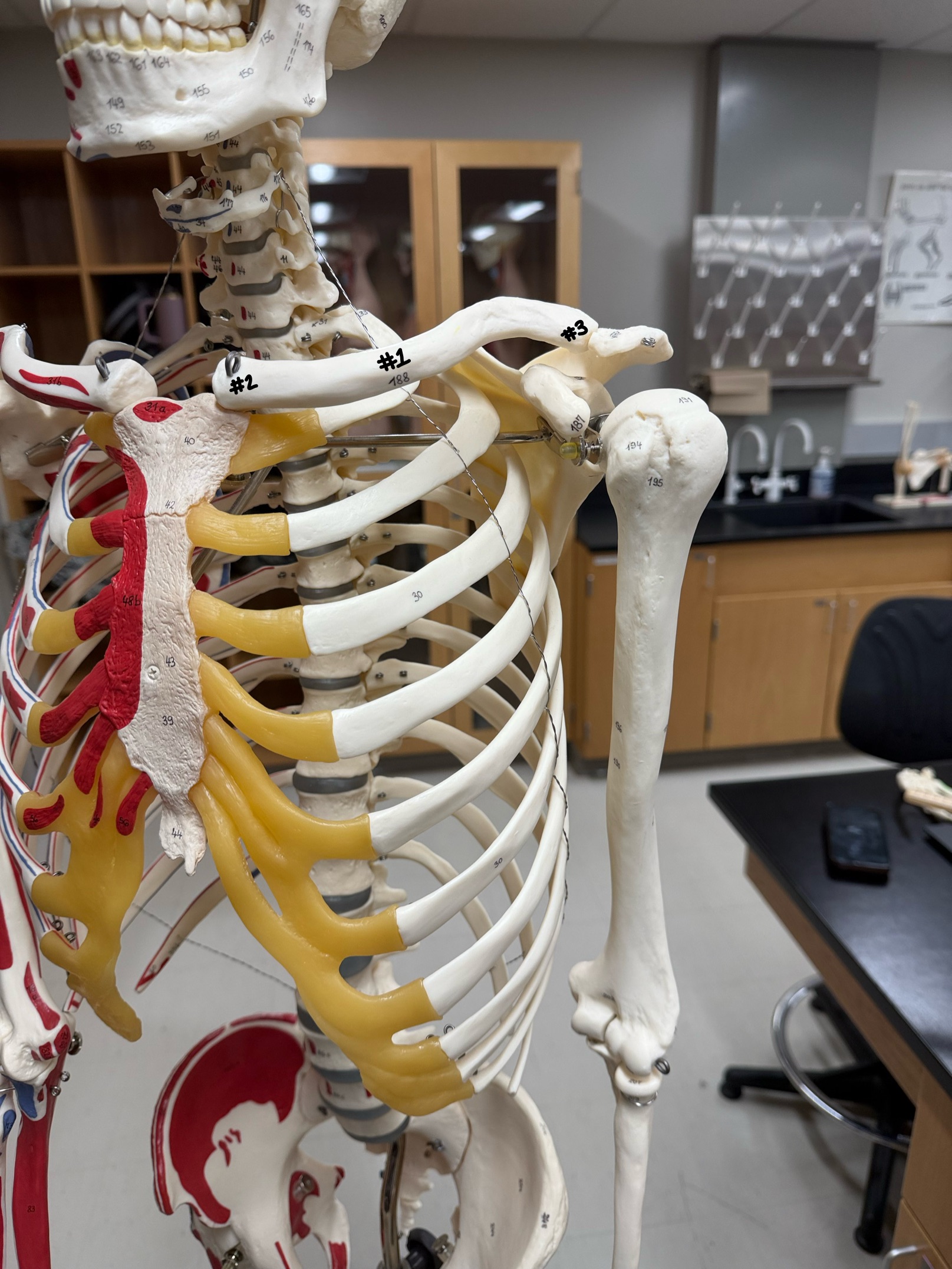 <p>what part of bone is labeled #2</p>