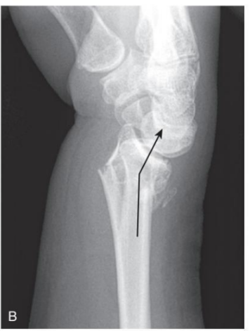 <p>diagnosis</p>