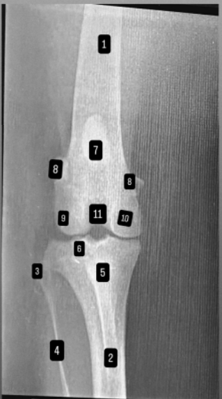 <p>podaj elementy od 1 -11</p>