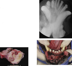 <p>This malignant tumor is associated with papillomavirus, affecting younger dogs (2-5 mo.) most commonly. Locally aggressive with bone lysis. No metastasis reported. Do surgical excision</p>