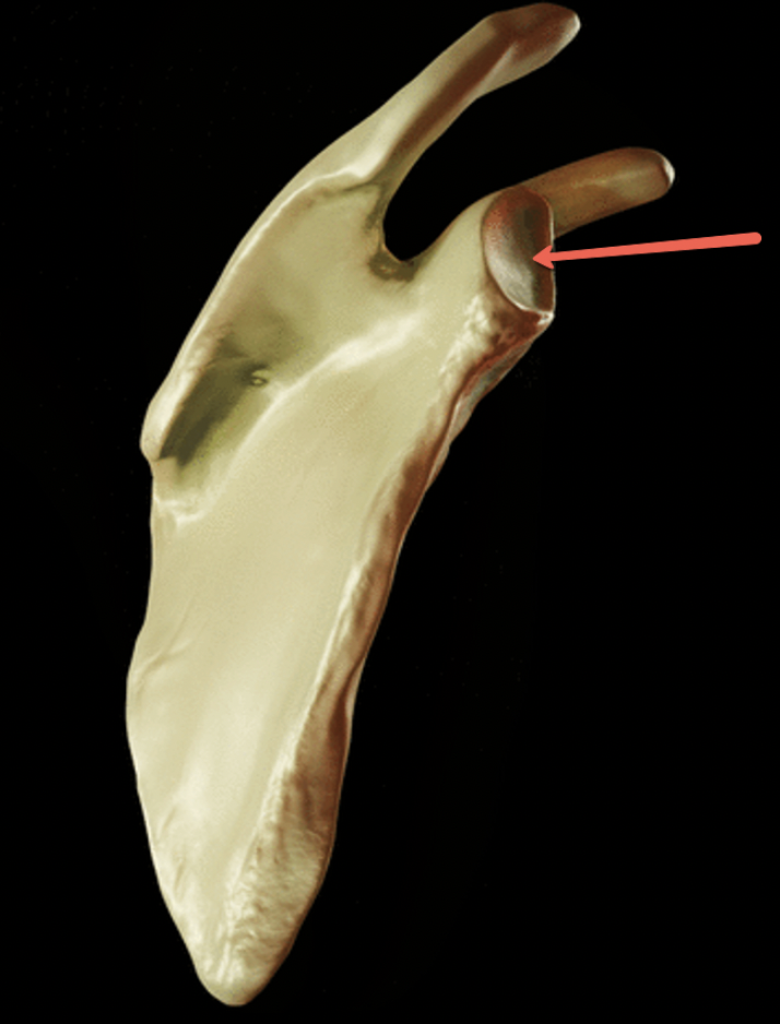 <p><strong>Identify the bone marking indicated by the pointer.</strong></p>