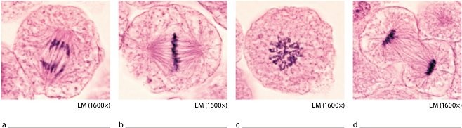 <p>Which image shows replicated chromatin.</p><p>a. a</p><p>b. b.</p><p>c. c</p><p>d. d</p>