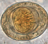 <p>Eggs has two shells with polar filaments, oncosphere has six hooklets</p>