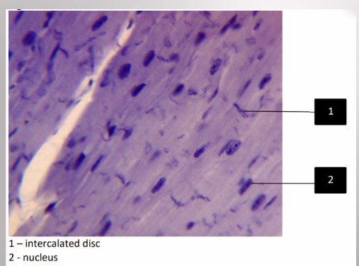 <p>cardiac muscle tissue</p><p>involuntary</p><p>striated</p><p>1-2 center nuclei per cell</p><p>intercalated discs</p><p>branched muscle fibers</p>