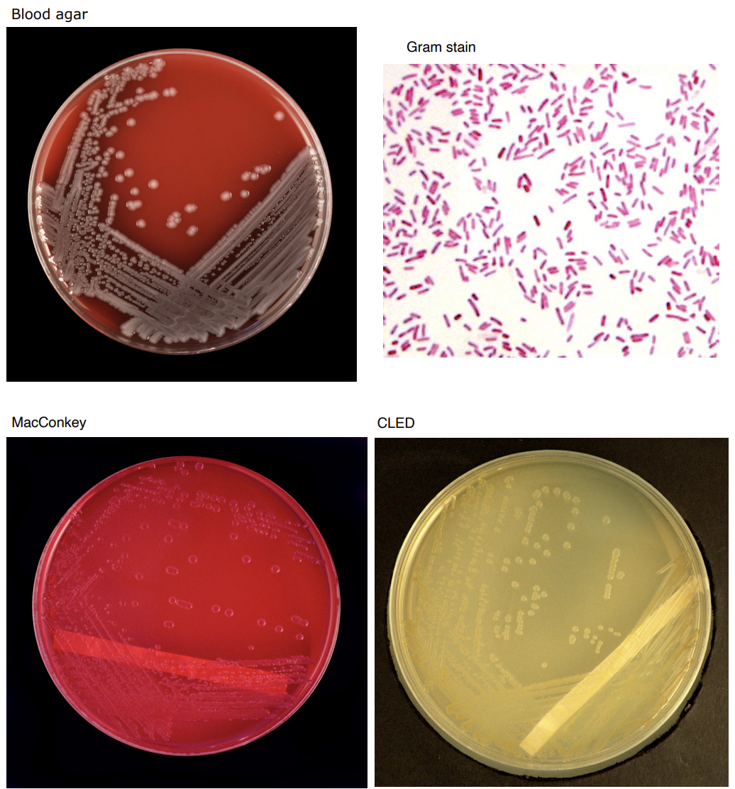 <p>E.coli</p>