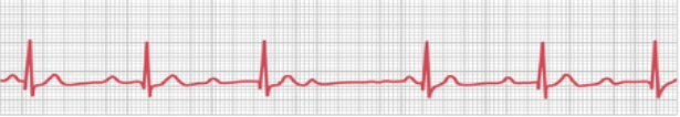 <p>what waveform is this</p>
