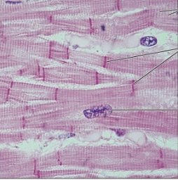 <p>what structures appear as darker lines?</p>