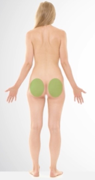 <p>Gluteus</p>
