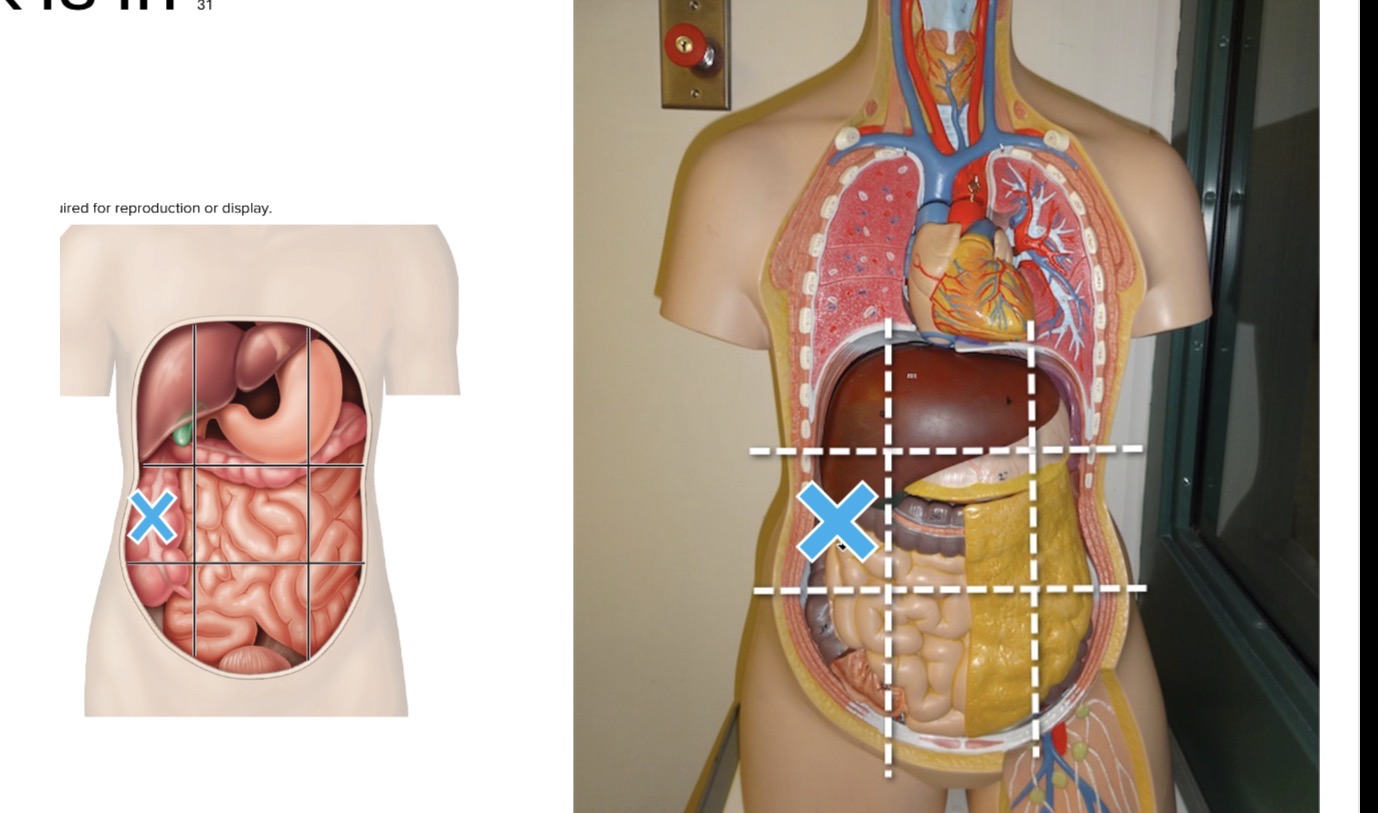 <p>Name the abdominopelvic region the mark is in</p>