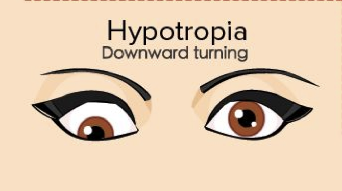 <p>goes downward</p>